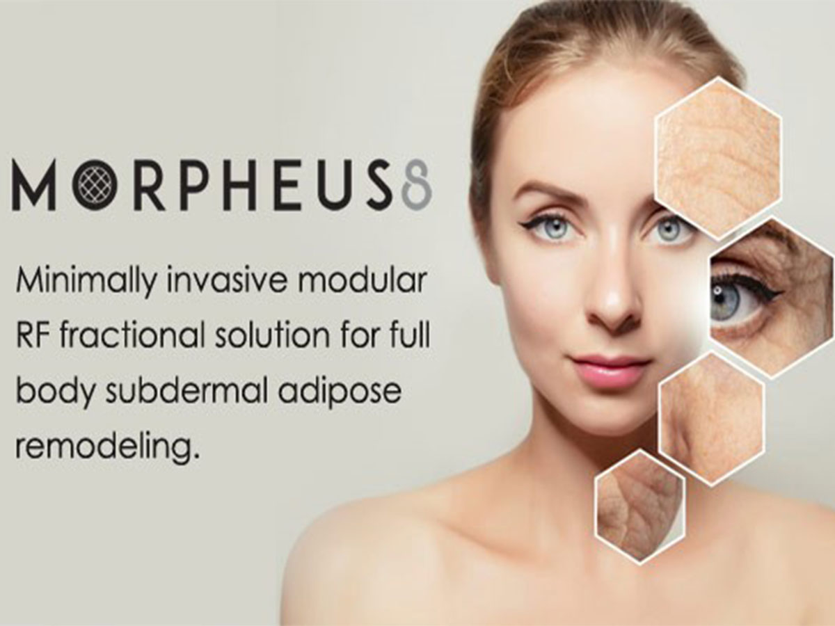 Microneedling